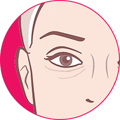 DARK CIRCLES