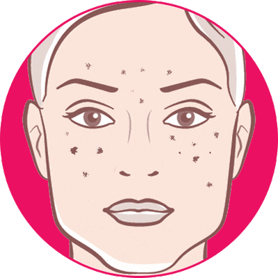 DARK SPOTS